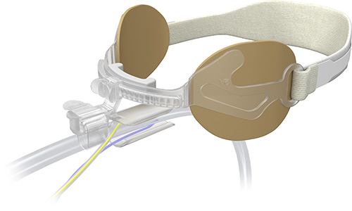 AnchorFast Guard Select